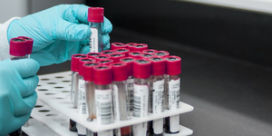 Unveil 8a21a6f614db065bb1ca2c21a5c803aede783f93e5277febbd47f37d9dbae4ca