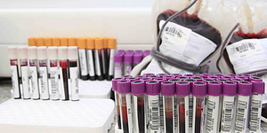 Unveil 8a21a6f614db065bb1ca2c21a5c803aede783f93e5277febbd47f37d9dbae4ca